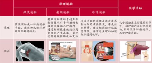 南微医学 688029 微创诊疗器械龙头